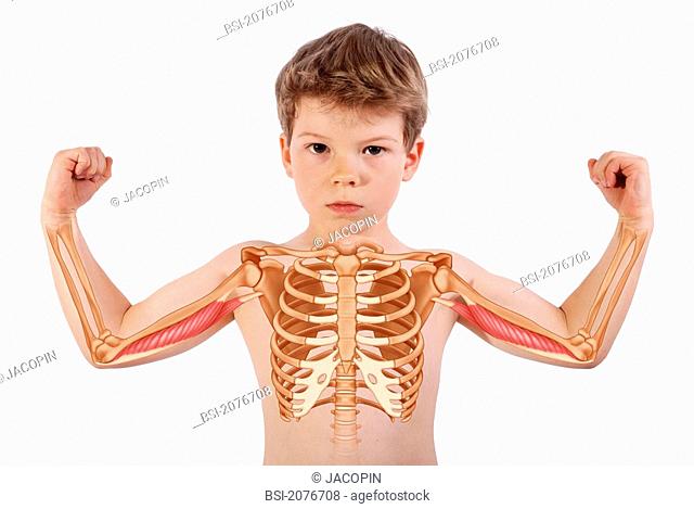 Rib Cage Deformities in Children